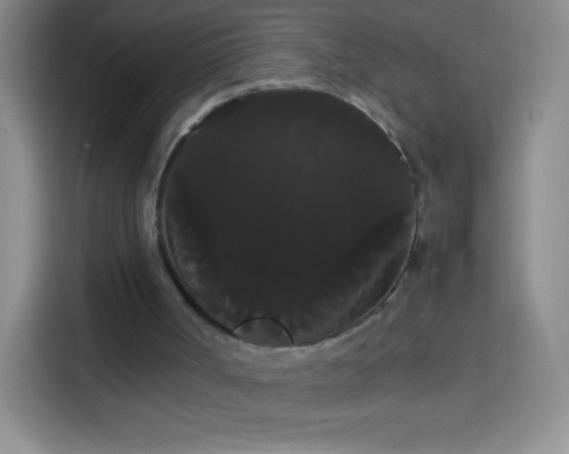 X0000113850002200910011010