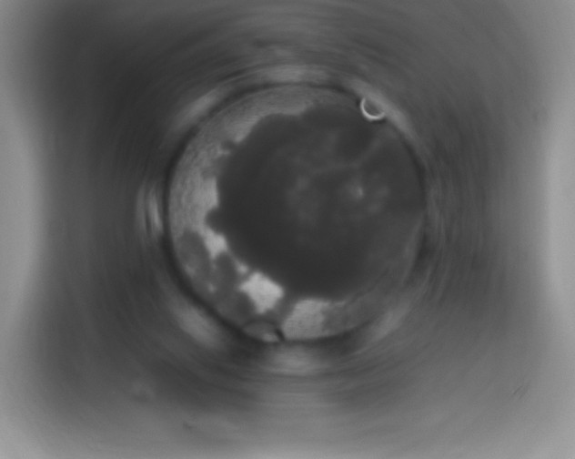 X0000113850062200910011009