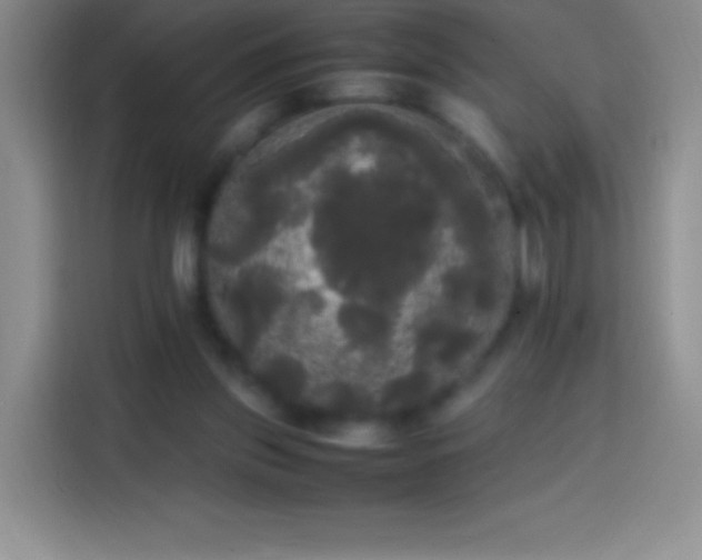 X0000113850157200910011008