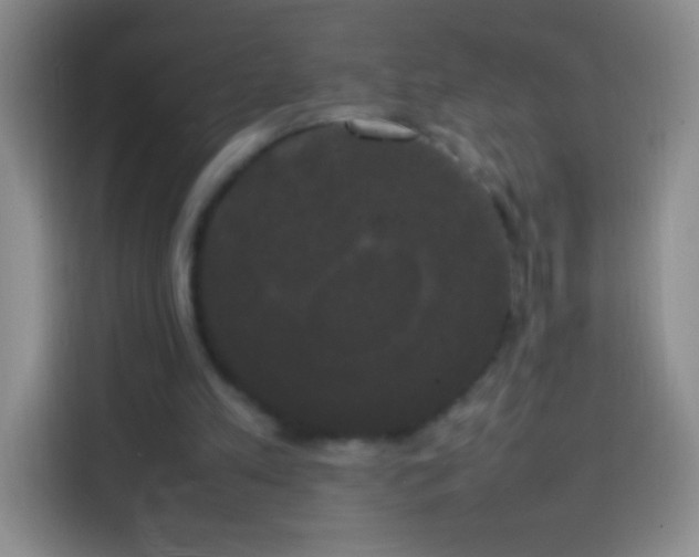 X0000113850197200910011007