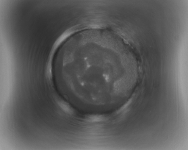 X0000113850246200910011006