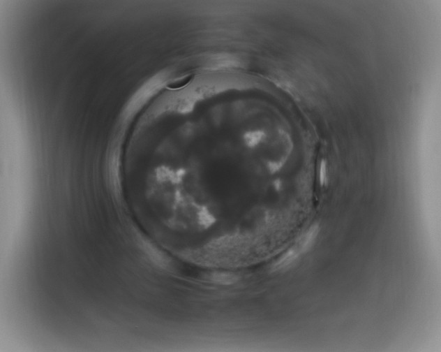 X0000113850341200910011005