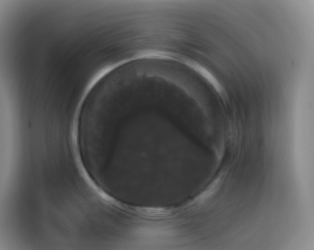 X0000113851007200910010957