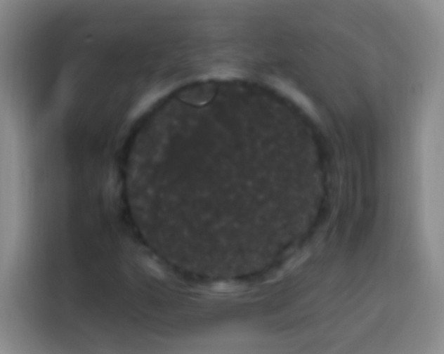 X0000113851160200910010955