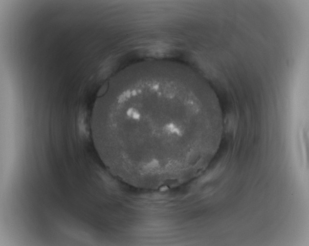 X0000113851202200910010954