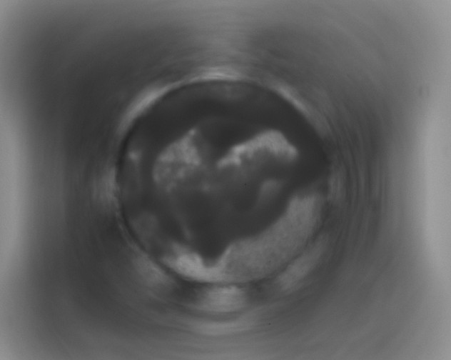 X0000113851454200910010951