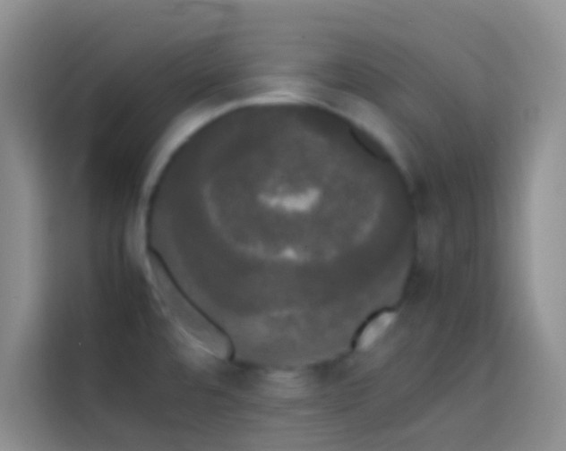 X0000113851480200910010951