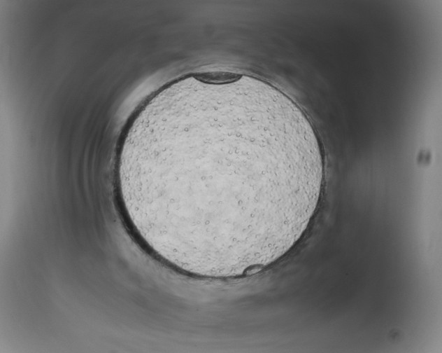 X0000113850007200910221429