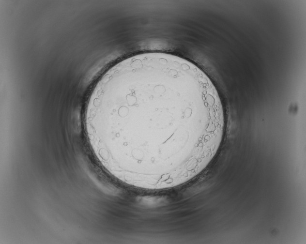 X0000113850251200910221425