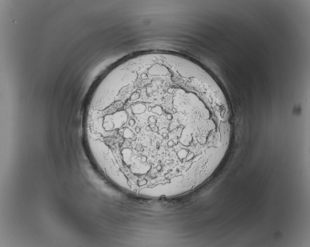 X0000113850987200910221415