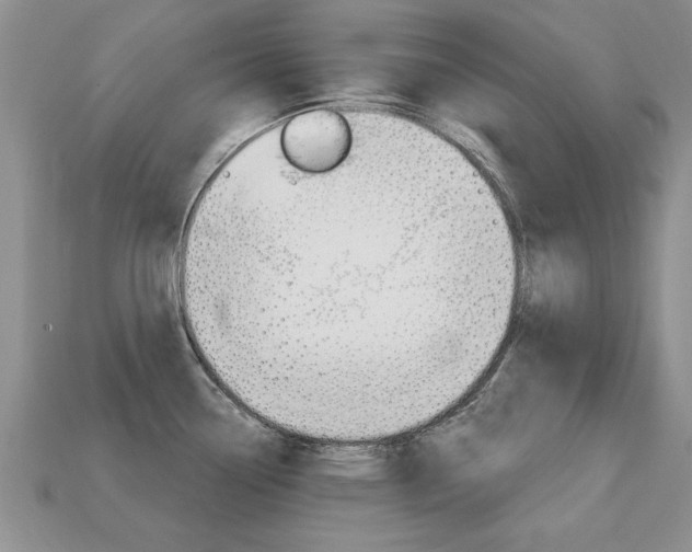 X0000113861338200909241018