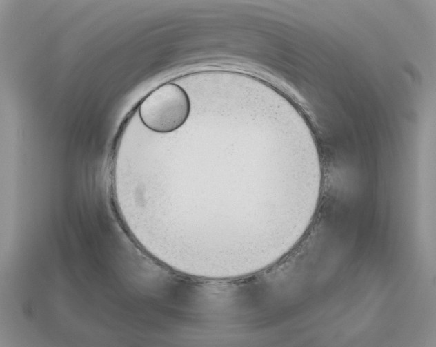 X0000113861514200909241015