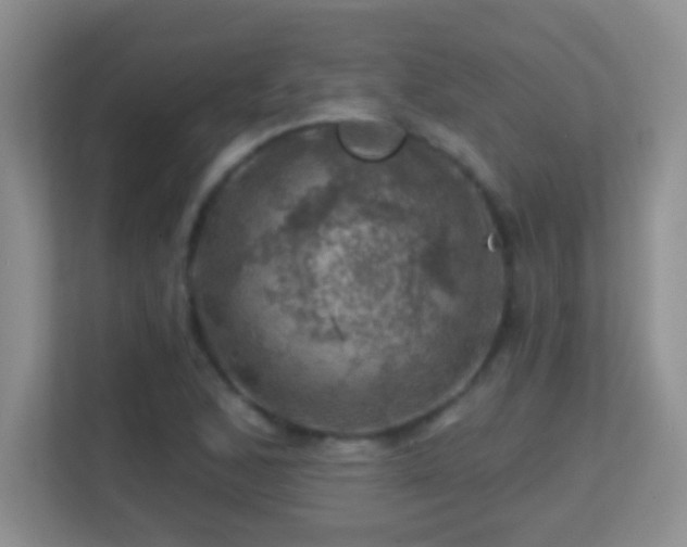 X0000113861168200909241302