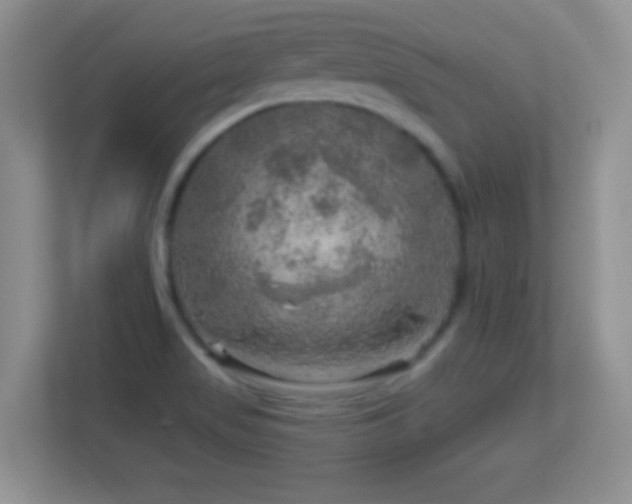 X0000113861517200909241257