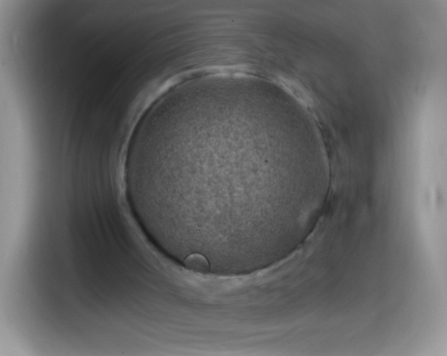 X0000113860002200910011030