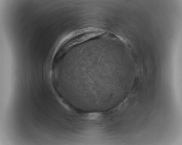 X0000113860050200910011029