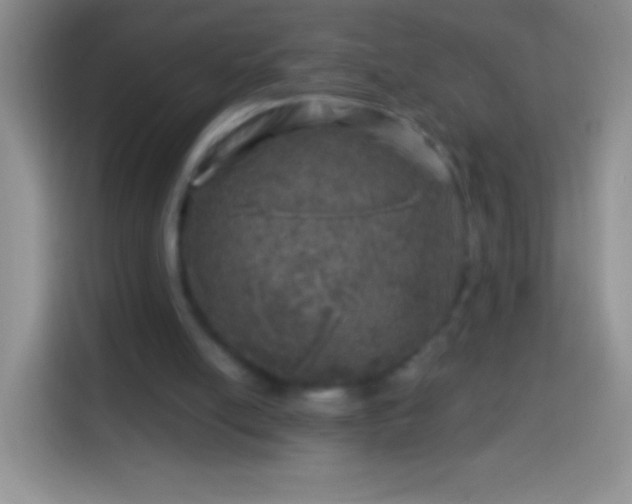 X0000113860054200910011029