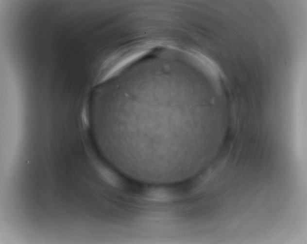 X0000113860062200910011029