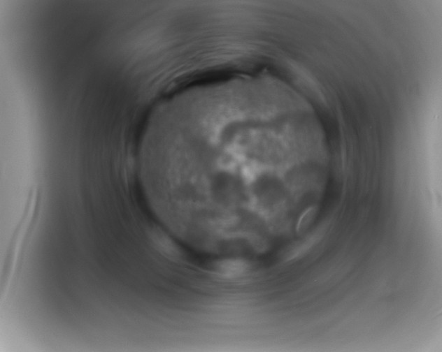 X0000113860085200910011030