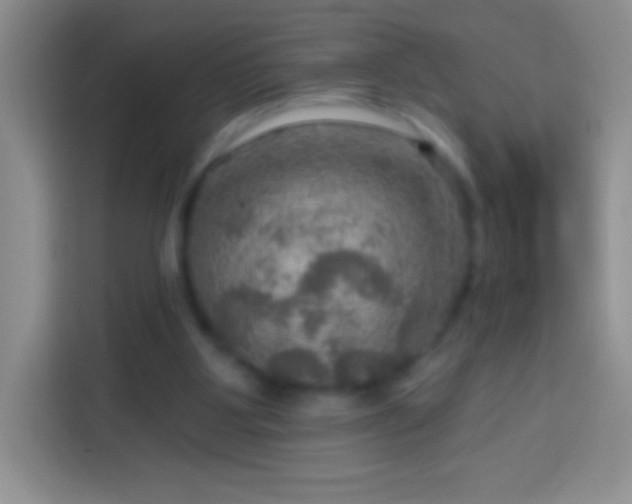 X0000113860107200910011029