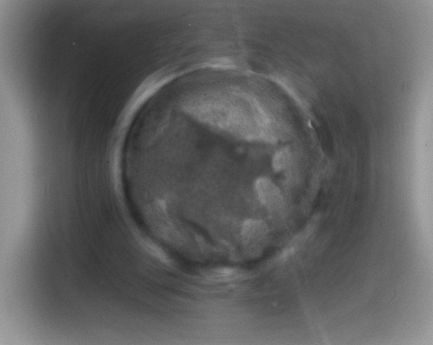 X0000113860151200910011028