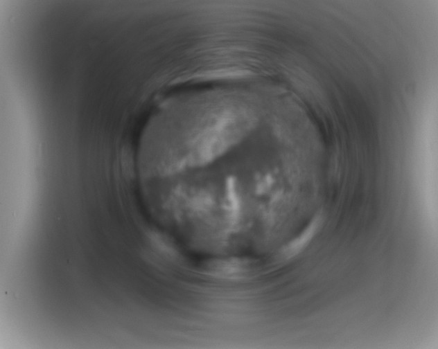 X0000113860182200910011028