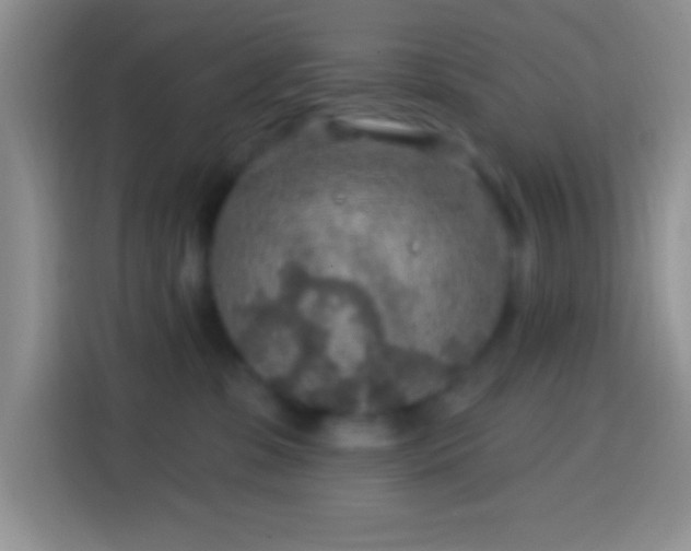 X0000113860331200910011026