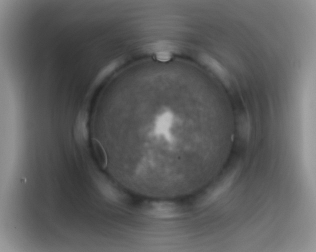 X0000113860395200910011025