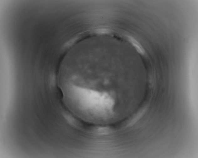 X0000113860401200910011025