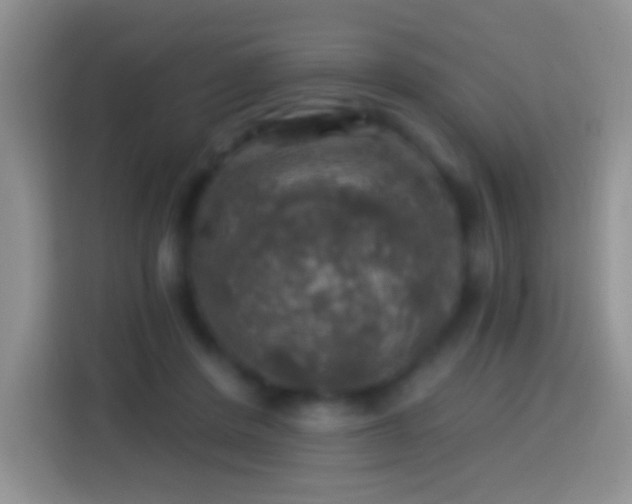 X0000113860408200910011025