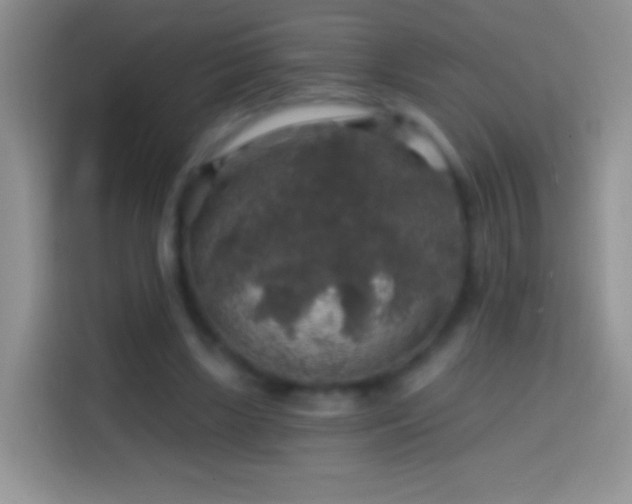 X0000113860443200910011024