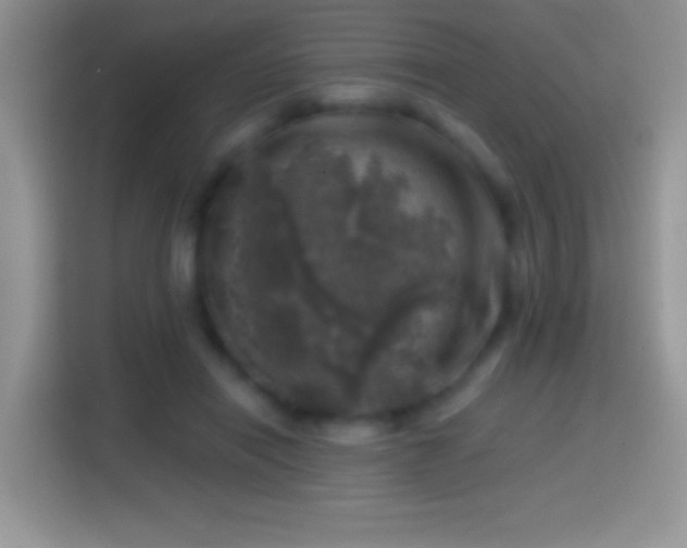 X0000113860454200910011025