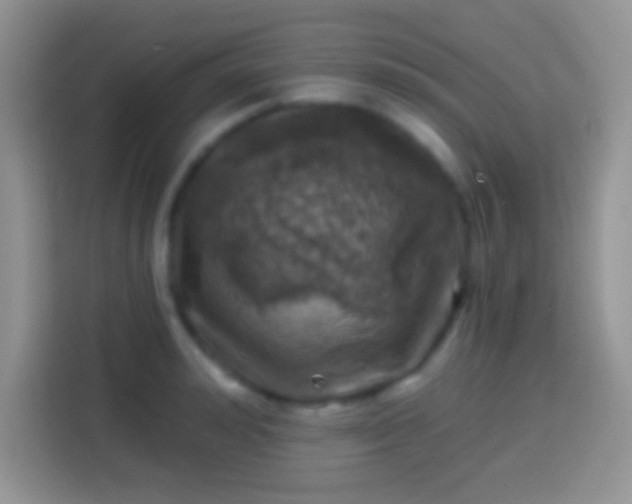 X0000113860992200910011018