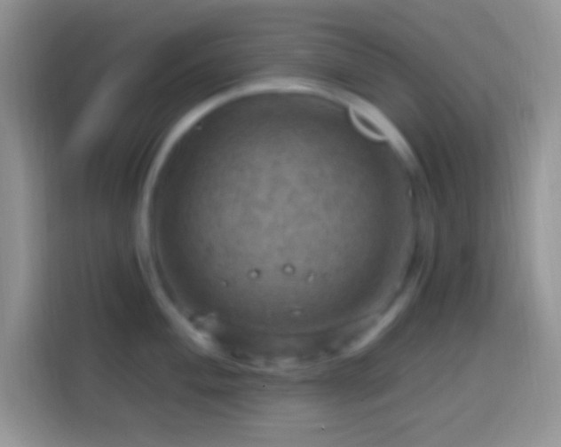 X0000113861004200910011017
