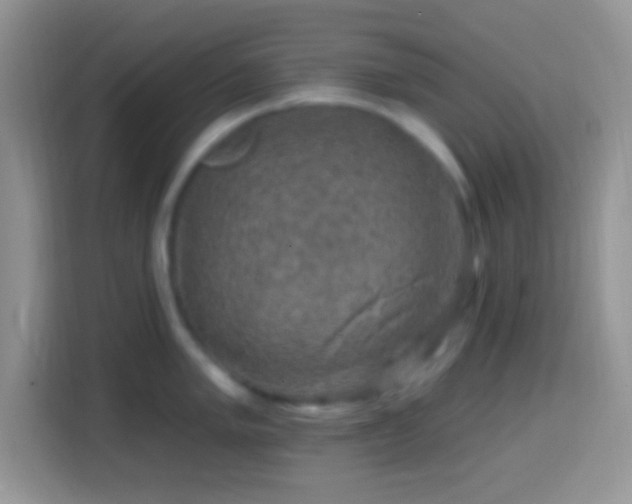 X0000113861005200910011017