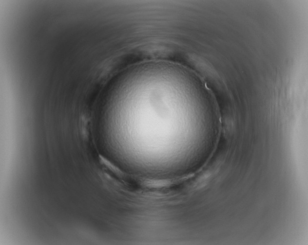 X0000113861010200910011017