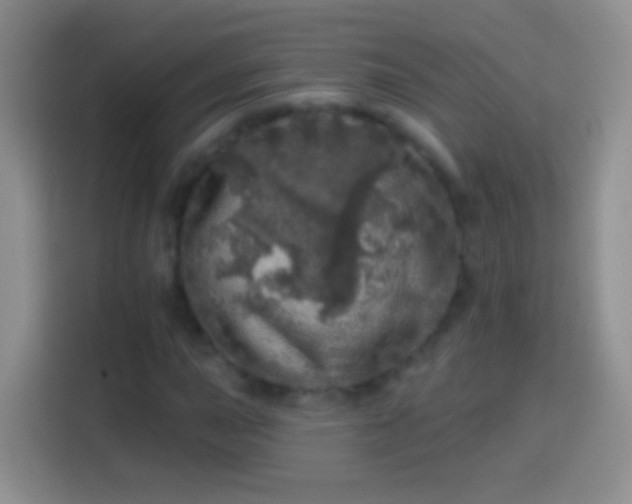 X0000113861015200910011017