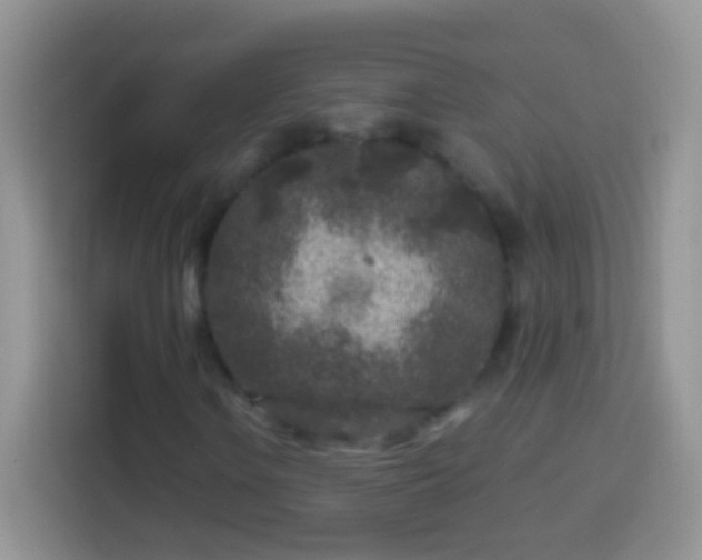 X0000113861106200910011016