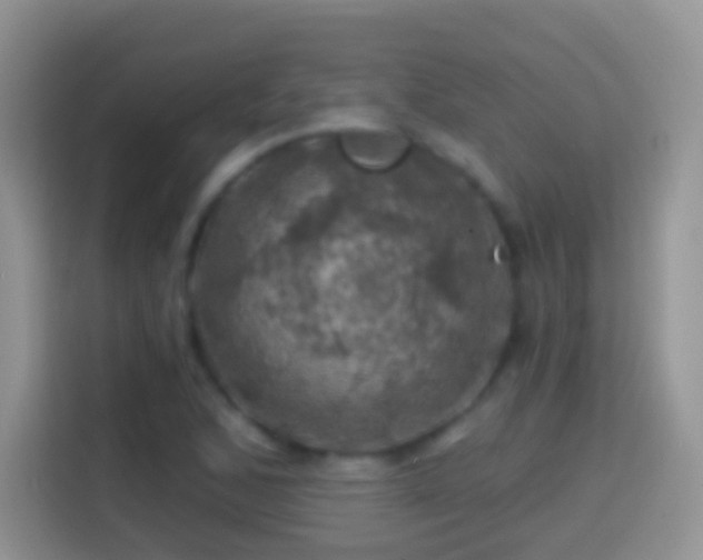 X0000113861168200910011015