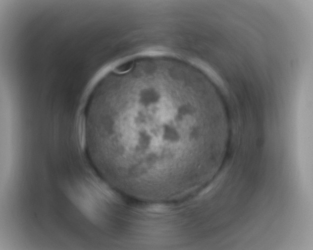 X0000113861175200910011015