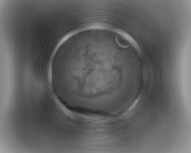 X0000113861238200910011015