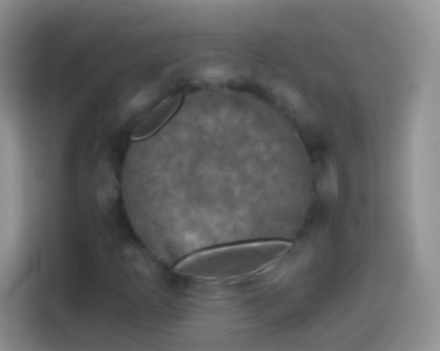 X0000113861253200910011014