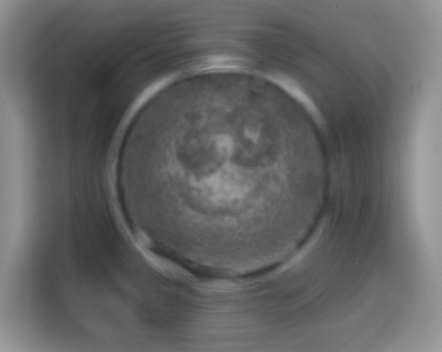 X0000113861333200910011014