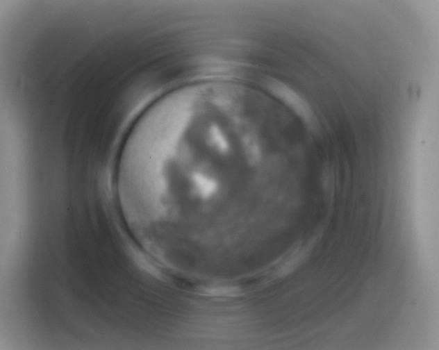 X0000113861466200910011011
