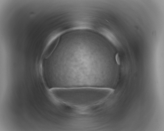 X0000113861468200910011011