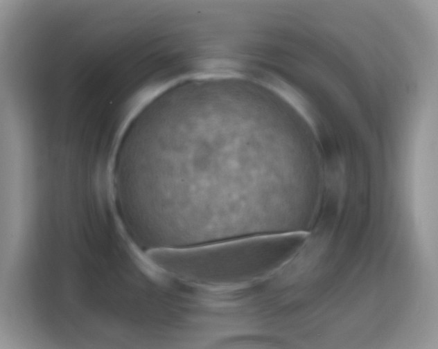 X0000113861485200910011011