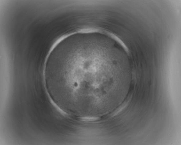 X0000113861487200910011011