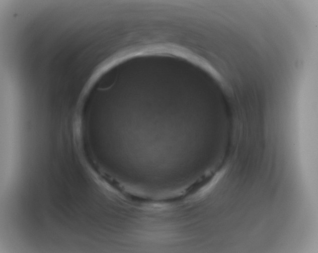 X0000113861506200910011010