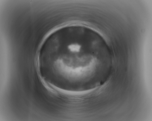 X0000113861515200910011011