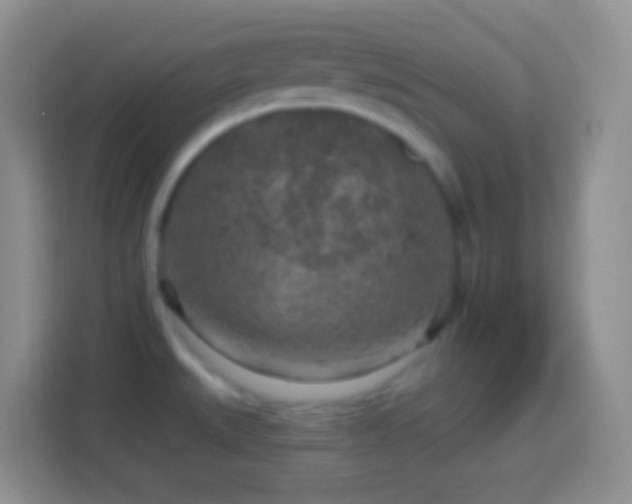 X0000113861527200910011011